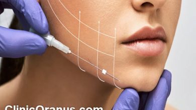 لیفت صورت با نخ؛ راز چهره‌ های همیشه جوان