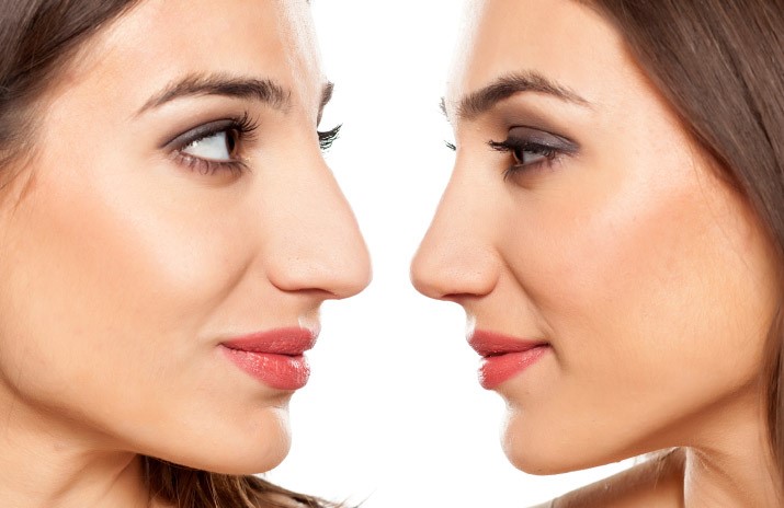 آیا بعد از عمل بینی احتمال عفونت وجود دارد؟