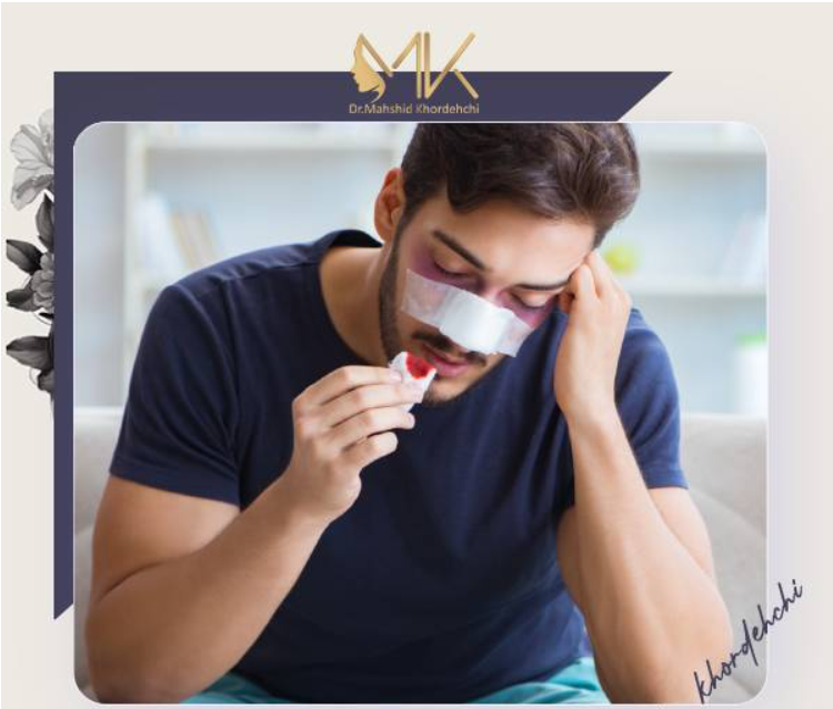 خونریزی بعد از عمل بینی | دکتر خورده چی