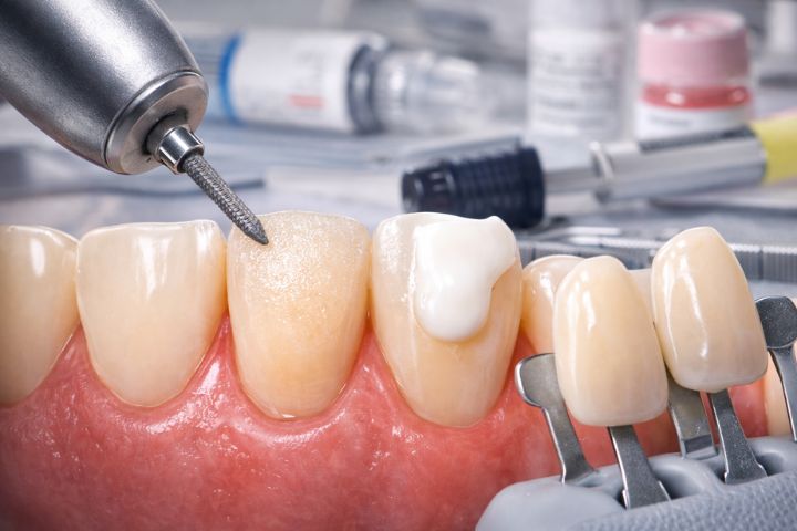 تراش حداقلی دقیقاً یعنی چه؟