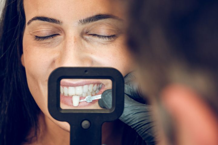 تفاوت تراش برای کامپوزیت با تراش در لمینت سرامیکی