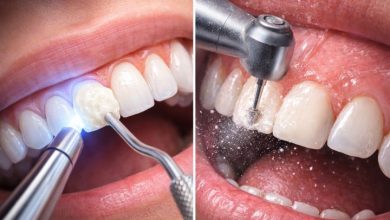 کامپوزیت بدون تراش دندان: واقعیت یا تبلیغ؟