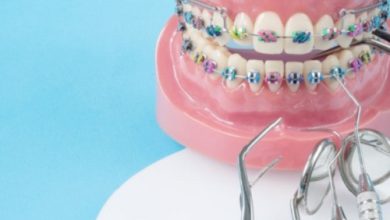 اهمیت درمان ارتودنسی در بزرگسالی؛ چرا به تعویق انداختن درمان می‌تواند هزینه بیشتری داشته باشد؟