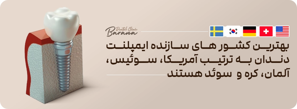 استفاده از برندهای معتبر ایمپلنت، ضامن جوش خوردن درست پایه به استخوان است.