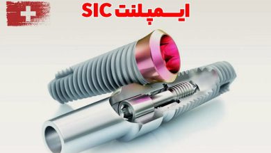 چرا موفقیت درمان با ایمپلنت، فقط به مهارت پزشک محدود نمی‌شود؟