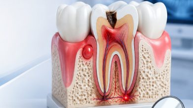 چه زمانی مراجعه به دندانپزشک عمومی کافی نیست؟