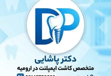 ایمپلنت دندان در ارومیه؛ راهکاری مطمئن برای جایگزینی دندان های از دست رفته