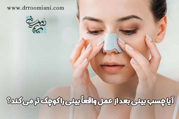 چسب زدن به بینی بعد از عمل | دکتر مریم رومیانی