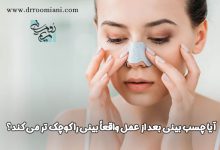 آیا چسب بینی بعد از عمل واقعاً بینی را کوچک تر می کند؟