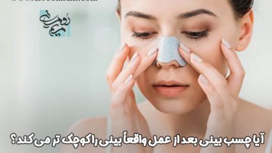آیا چسب بینی بعد از عمل واقعاً بینی را کوچک تر می کند؟