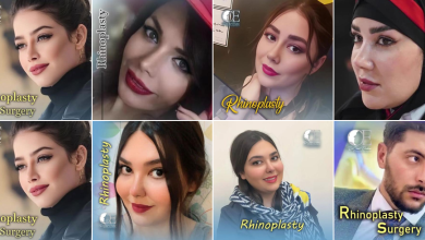 آشنایی با بهترین دکتر برای عمل بینی طبیعی