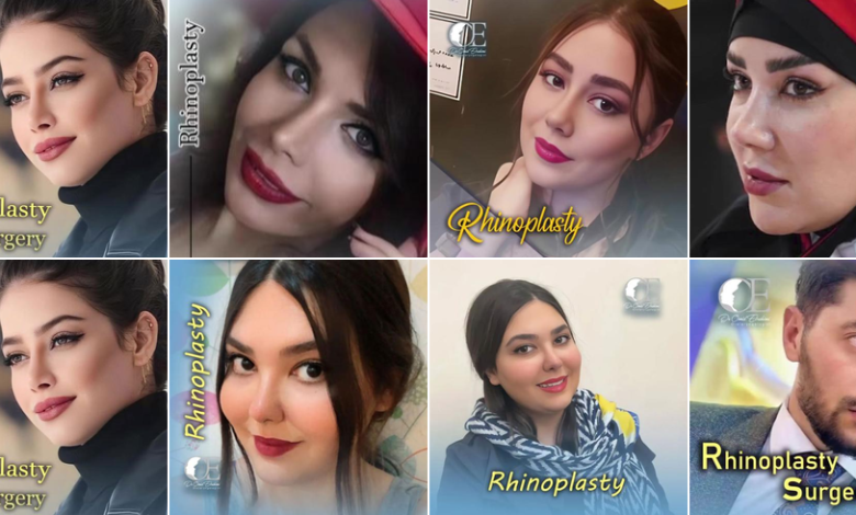 آشنایی با بهترین دکتر برای عمل بینی طبیعی