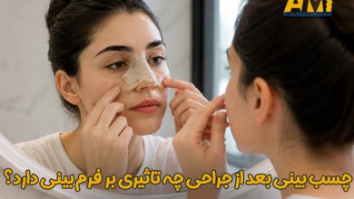 چسب بینی بعد از جراحی چه تاثیری بر فرم بینی دارد؟