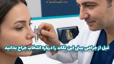 قبل از جراحی بینی این نکات را درباره انتخاب جراح بدانید
