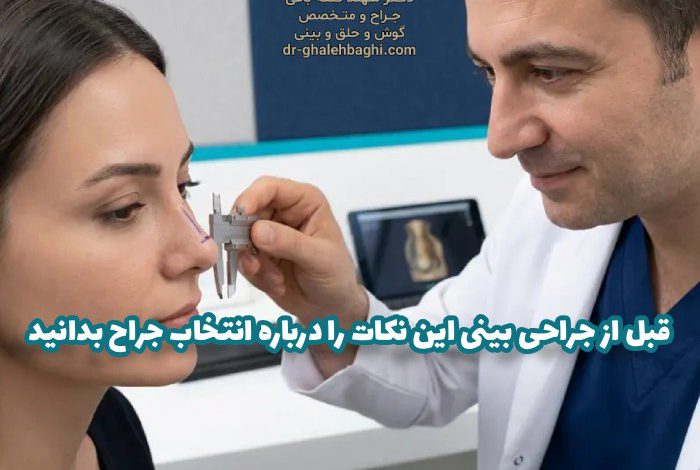 قبل از جراحی بینی این نکات را درباره انتخاب جراح بدانید