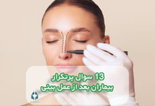 13 سوال پرتکرار بیماران بعد از عمل بینی