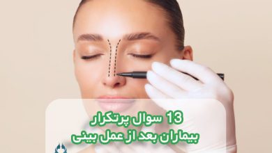 13 سوال پرتکرار بیماران بعد از عمل بینی
