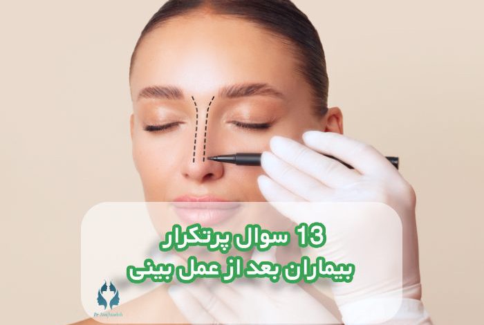 13 سوال پرتکرار بیماران بعد از عمل بینی