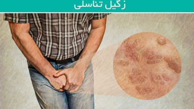 خطرات ابتلا به زگیل تناسلی