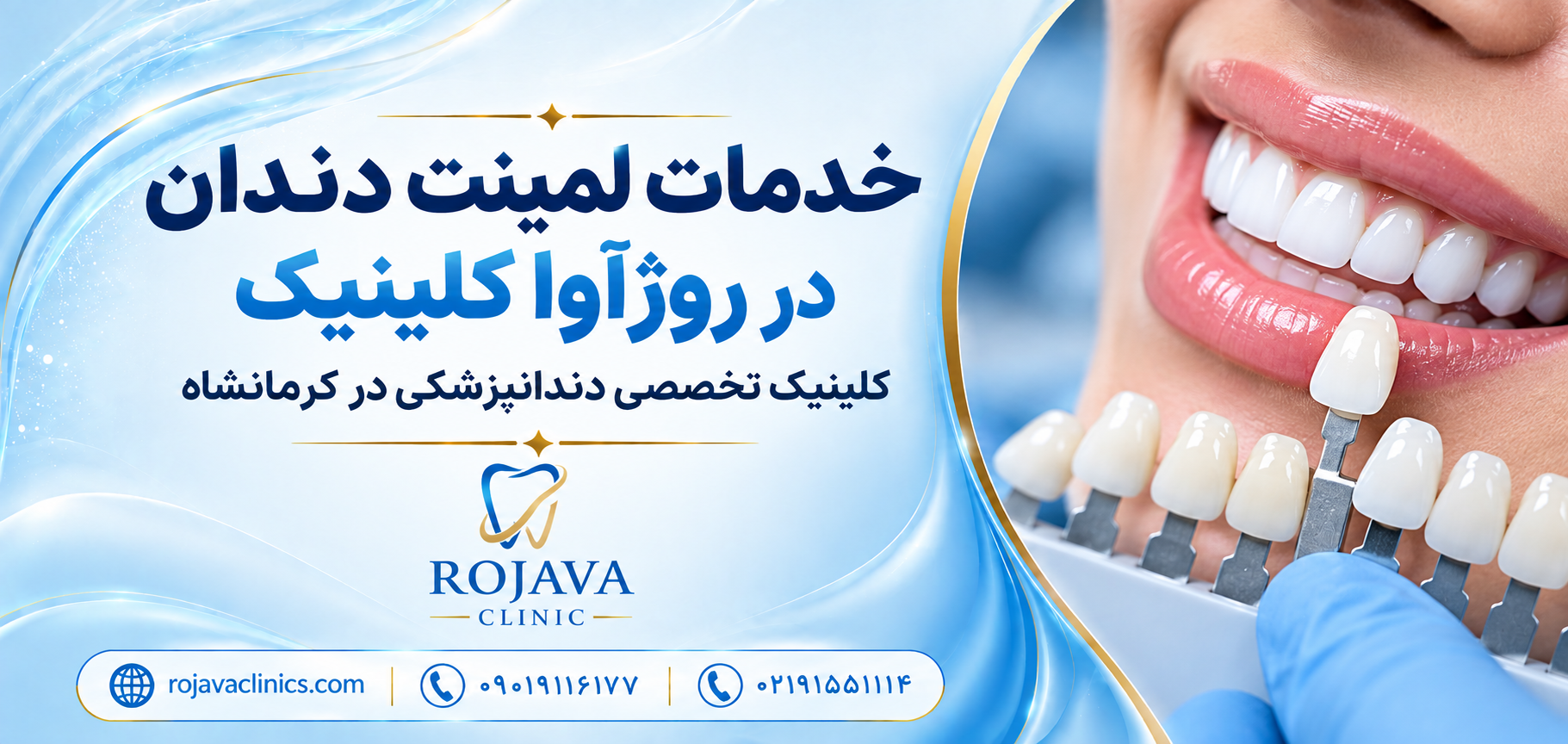 خدمات لمینت دندان در روژآوا کلینیک rojavaclinics.com