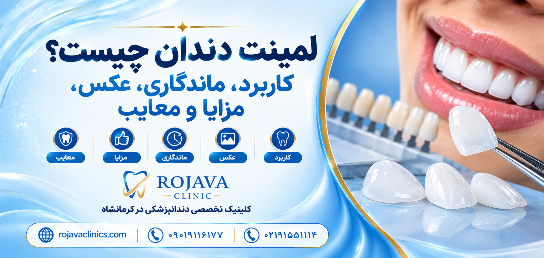 مراحل لمینت دندان از صفر تا صد | نحوه انجام و نصب لمینت